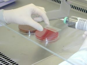 Hémoculture