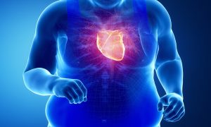 Insuffisance cardiaque aiguë