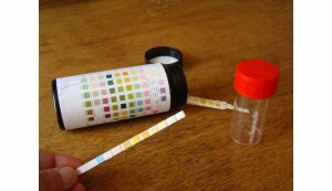 Test de gravité spécifique de l'urine