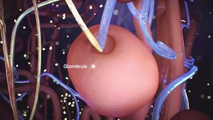 glomérulonéphrite