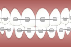 orthodontie